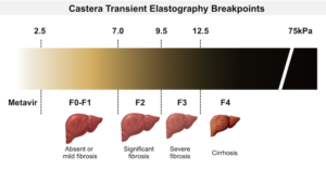 Core Concepts - Evaluation and Staging of Liver Fibrosis