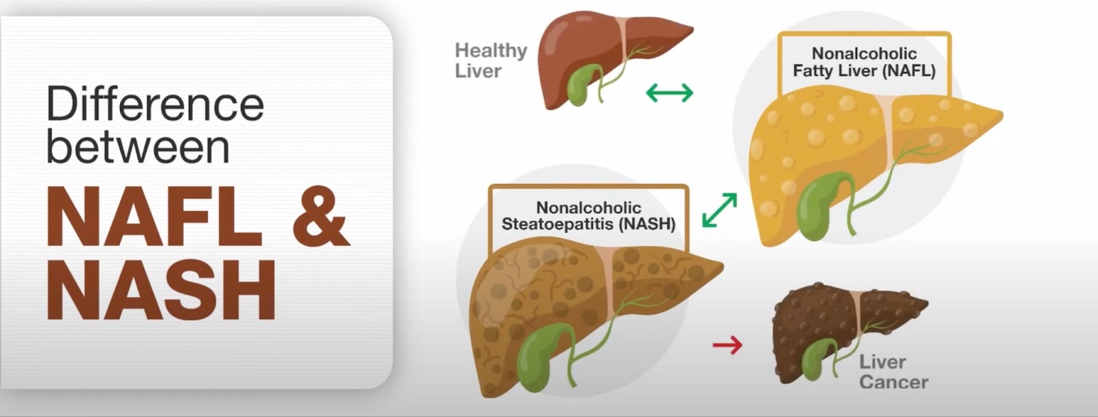 The inscription "Difference Between Nash and Nafld" on a white background with a liver