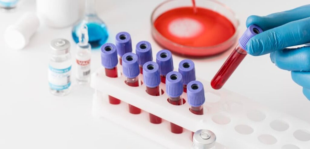 A lab technician placing blood vials in a rack with medical supplies in the background