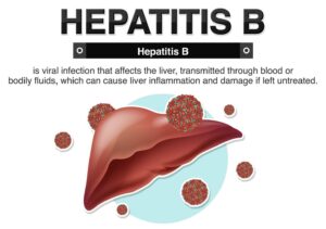 Hepatitis b near the liver